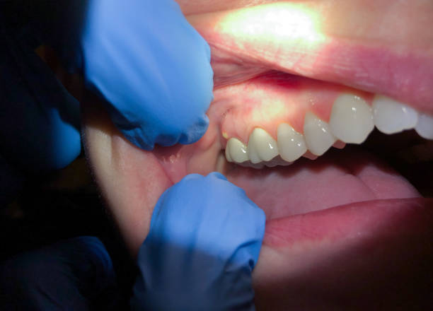 Best Emergency Dental Services for Seniors in Clinton, MI